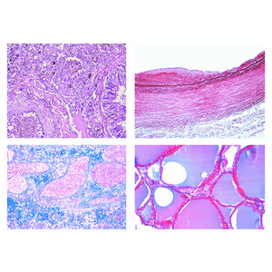 LIEDER Histología humana patológica, serie pequeña (50 prep.)